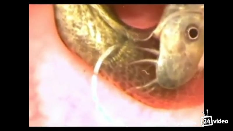 Zhest ekstrimalnaya rybalka ili klizma iz ryb