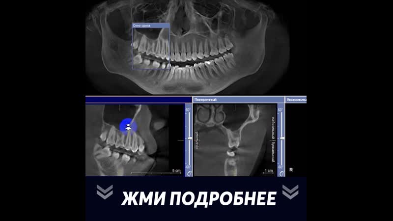 Консультация и диагностика + панорамный снимок + фторирование бесплатно!
