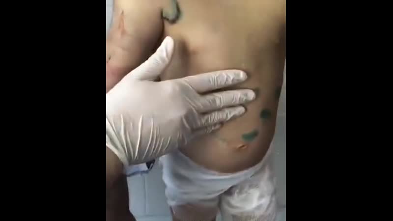 Семилетняя девочка подверглась жестоким истязаниям в ингушетии