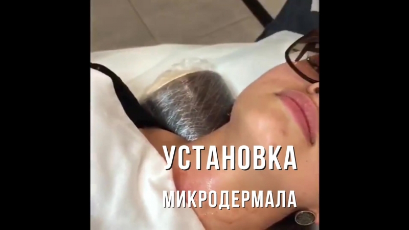 Устаноа микродермала