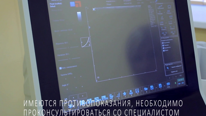 #миленарис #ультразвуковая подтяжка