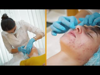 Osoba beauty club о пилингах