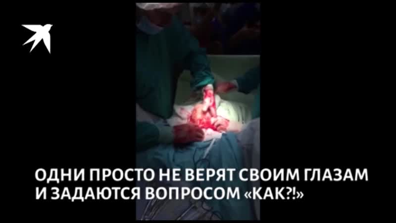 Шок контент врачи петербурга достали из пациента гигантское дилдо и выложили видео в сеть