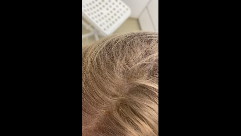 Последствие окрашивания