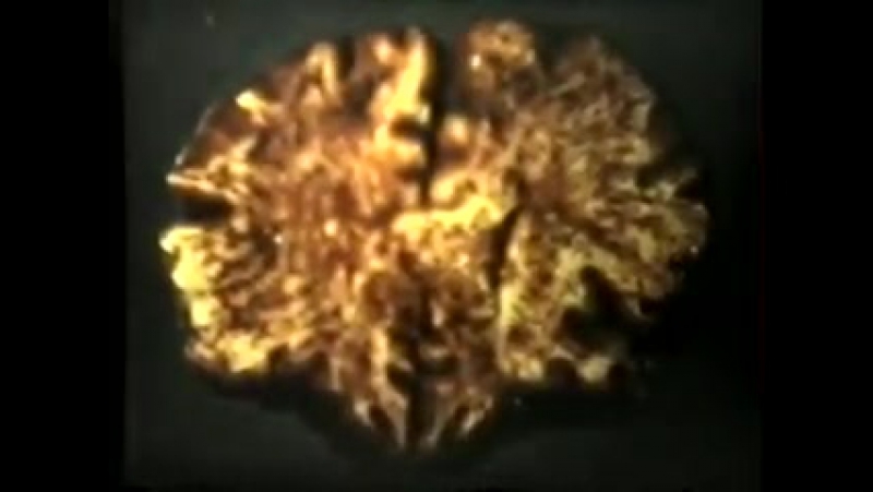 Судебно медицинская гистология