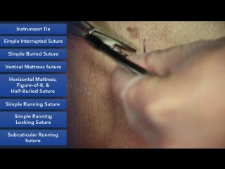 Duke suture skills course learn best suture techniques