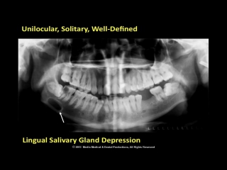 Radiographic interpretation the differential diagnosis pl i 4 of 8
