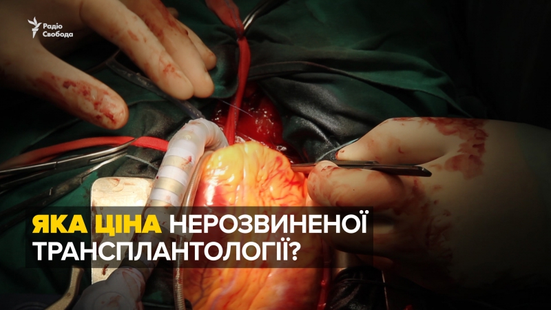 Яка ціна нерозвиненої транспланталогії?