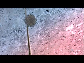 Virus infects a cell on vimeo