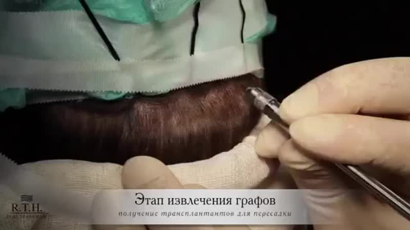 Пересадка бровей в клинике rth!