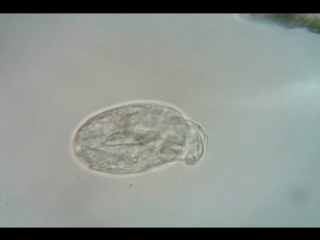 Rotifer hatching from egg