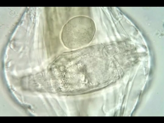 Rotaria macroceros (rotifer), with young