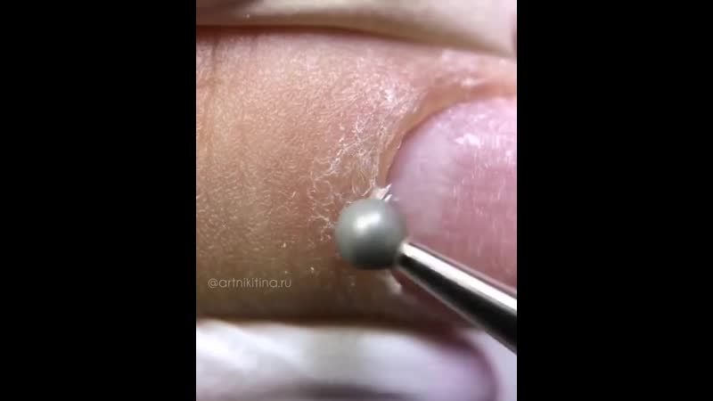 Срез кутикулы