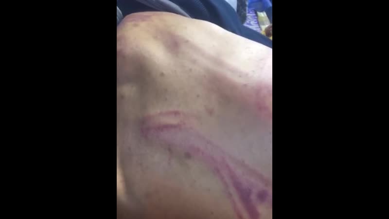 +18 ирак видео, на котором показаны последствия пыток, которым правительственные боевики подвергли одного из протестующих
