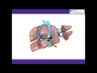 Alpps procedure animation a surgical solution for initially unresectable liver tumours