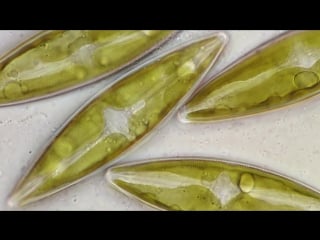 Stauroneis diatom full hd bf microscope