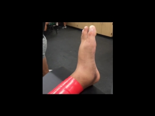 Rockfloss + rockpods против отека