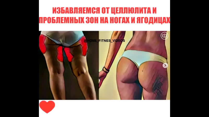 Избавляемся от целлюлита!