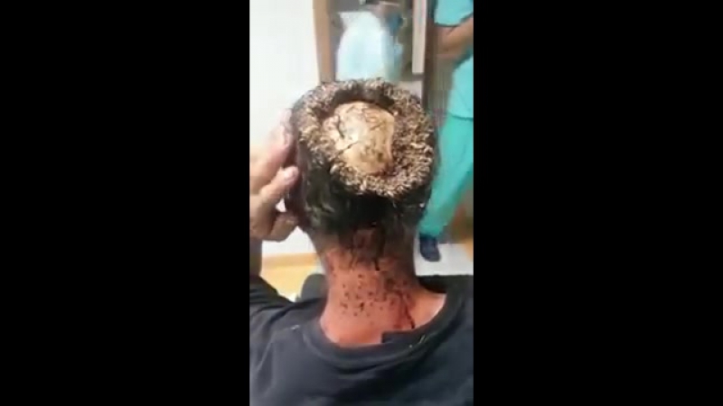 Охренеть черви, пожирают голову человека