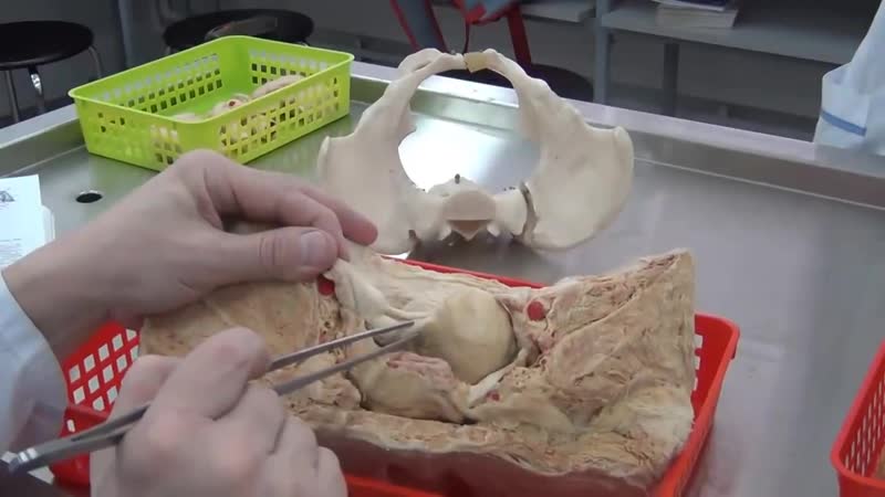 Женская половая система анатомический препарат комплекс органов малого таза (проф в а изранов)