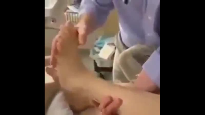 Гиперактивные рефлексы