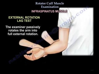 Rotator cuff muscle examination everything you need to know dr nabil ebrahe