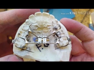 How to custom fit ortho molar bands lesson 1 ортодонтия