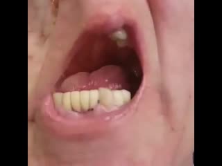 Как вам протез?