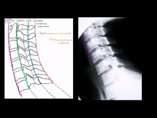 Оценка расположения шейного отдела позвоночника (шеи) на рентгеновских снимках в боковой проекции