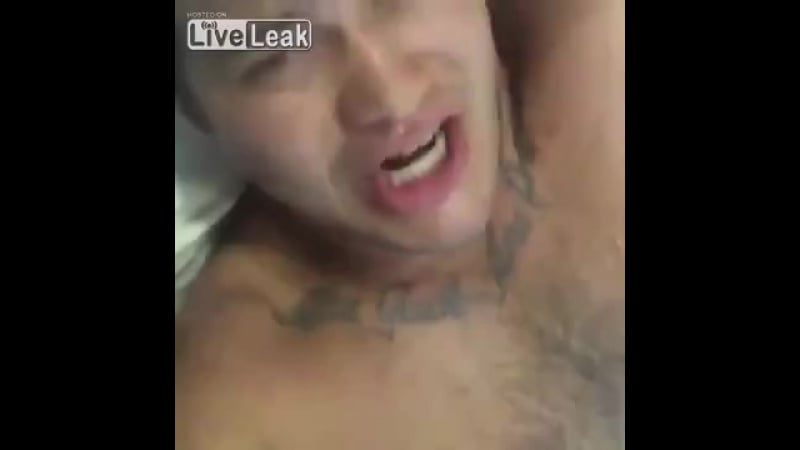 Акула откусила ногу