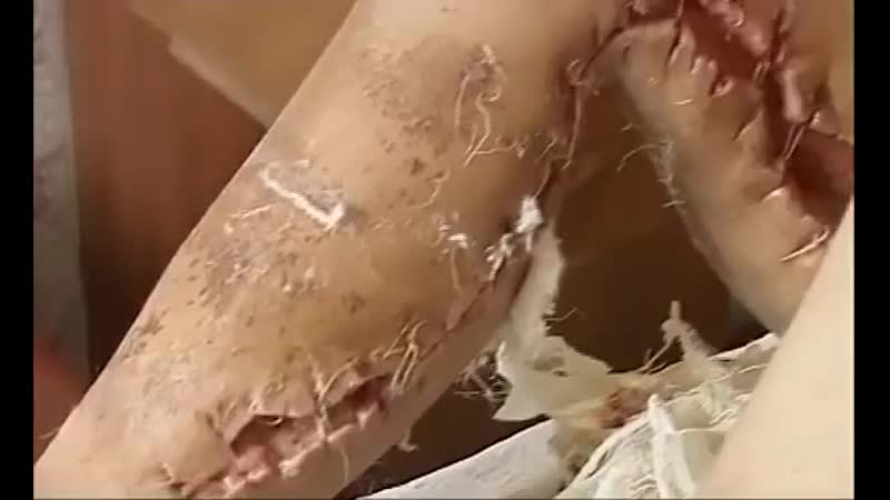 Дезоморфин самый ужасный молодые слабонервным категорически секс