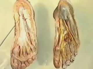 Топографическая анатомия области стопы