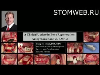 A clinical update in bone regeneration autogenous bone vs bmp 2