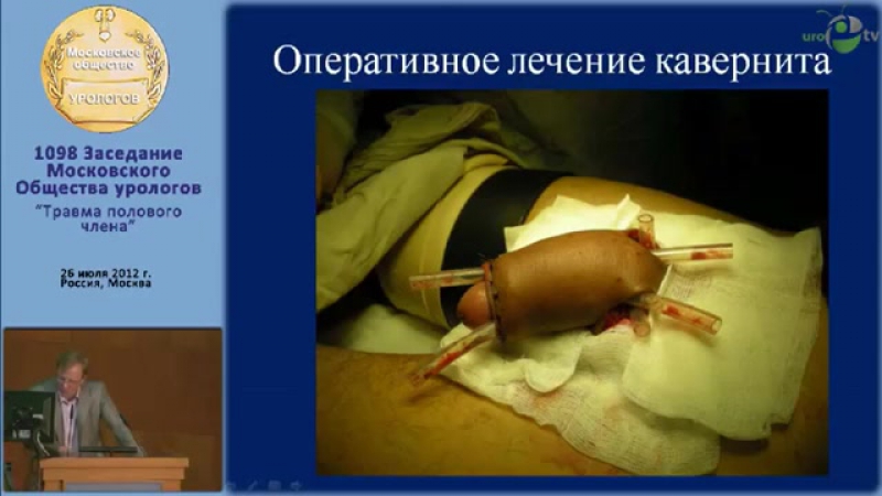 Тактика porn video – Приапизм лечебная тактика