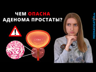 Аденома простаты что это? суть, причины, симптомы и диагностика дгпж у мужчин| mednavigator ru