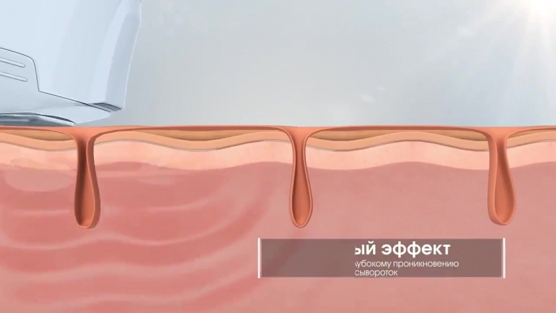 Artistry porn video – Artistry dermasonic