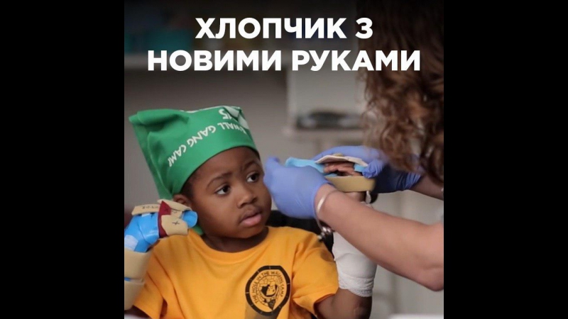 Хлопчик з новими руками
