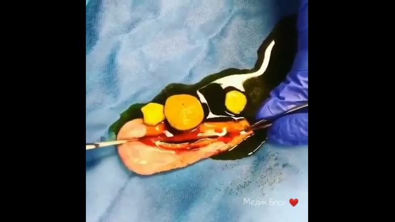 Какой орган вы видите в этом видео?