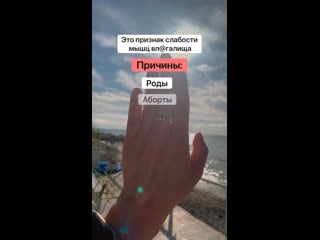 Половая щель зияет?