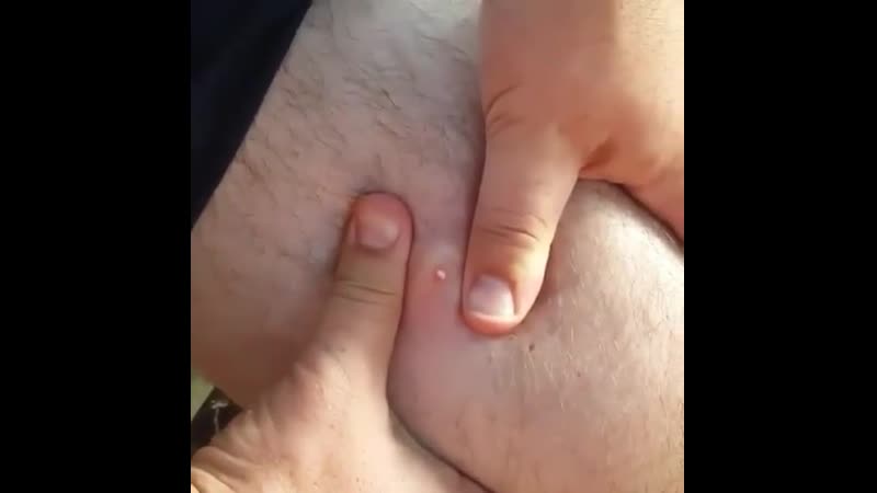 Ночных взрывоопасных прыщей вам в ленту ♥️