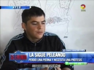 Lb24 perdió la pierna hace 2 años y necesita ayuda canal 7