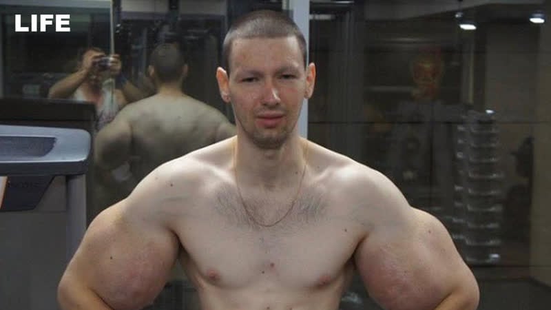 Кириллу руки базуки терешину откачивают синтол