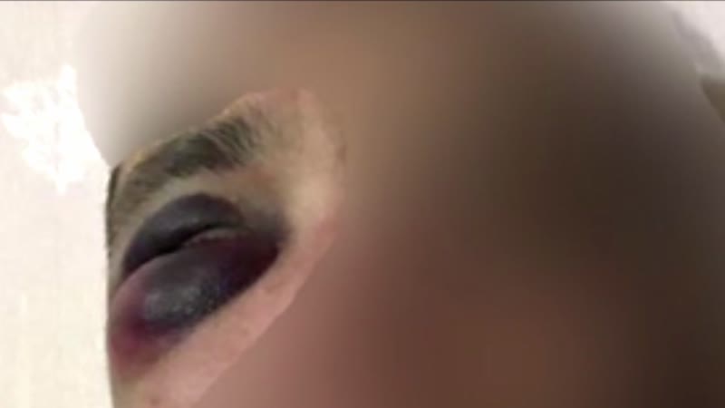 Видео брест парень