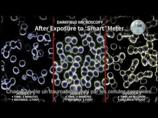 Compteur linky la mort à domicile