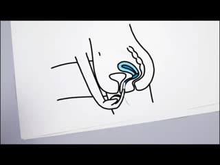 Sll как использовать тампоны (o b ®)