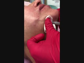 Иньекционный курс "контурная пластика"