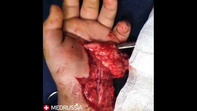 Пульсирующая артерия 😱