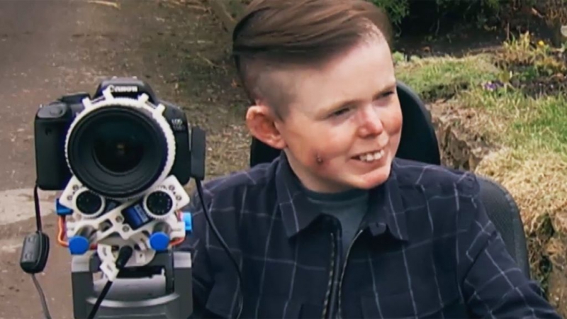 Смертельно больной британец получил необычную камеру