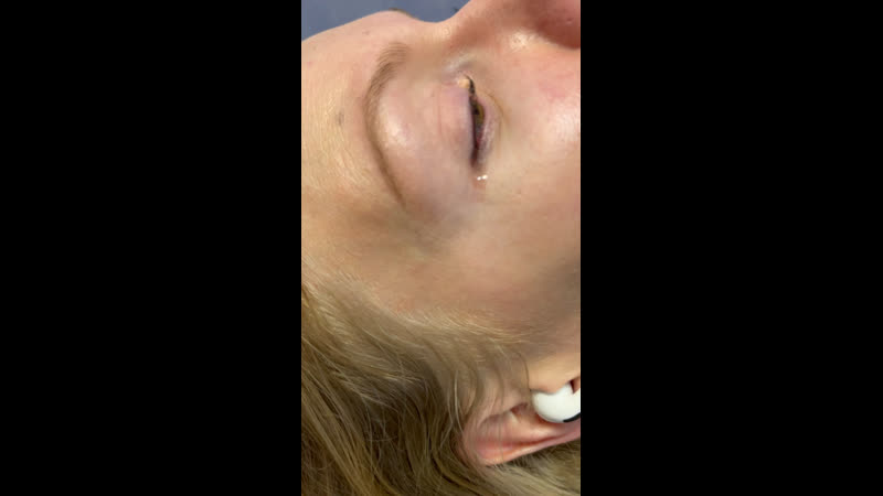 Ламинирование ресниц c ботоксом