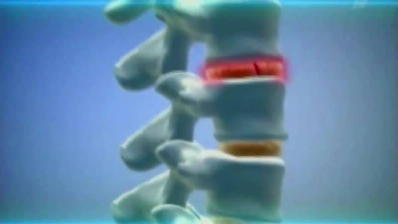 Лечение позвоночника бегом